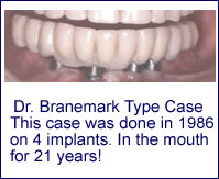 Implant Restorations in Scarsdale NY, Westchester County