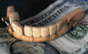 George Washington's Denture at the National Museum of Dentistry