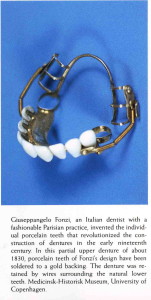 Partial Denture 1830